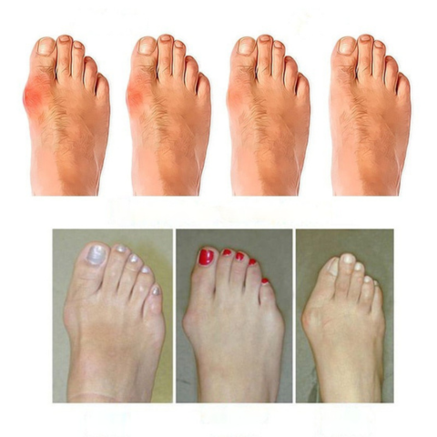 Anita | Sandale Deschise – Eleganță Relaxată pentru Vară 